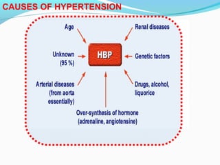 CAUSES OF HYPERTENSION
 