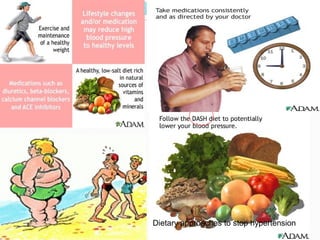 Dietary approaches to stop hypertension
 