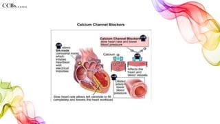 CCBs…....
 