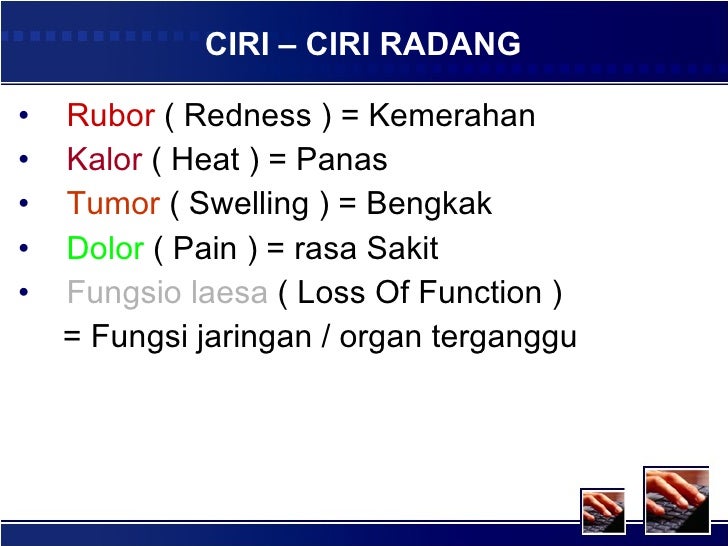 Trend Terpopuler 30 Ciri Ciri Kacamata Anti Radiasi Trend Terpopuler 30 Ciri Ciri Kacamata Anti Radiasi