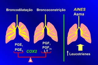 Broncodilatação   Broncoconstrição     AINES
                                       Asma




    PGE1             PGF1
                     PGF2α
    PGE2              LT
           COX2
                                     Leucotrienes
 