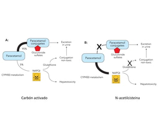 Carbón activado

N-acetilcisteina

 