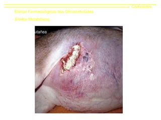 Corticóides
Efeitos Farmacológicos dos Glicocorticóides
Efeitos Metabólicos
Calcinose cutañea
 