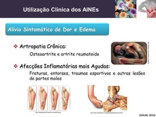 Utilização Clínica dos AINEs
(GOLAN, 2014)
Alívio Sintomático de Dor e Edema
 Artropatia Crônica:
Osteoartrite e artrite reumatoide
 Afecções Inflamatórias mais Agudas:
Fraturas, entorses, traumas esportivos e outras lesões
de partes moles
http://oqueeh.com.br/artrite-reumatoide
http://ortopediasp.wordpress.com/tag/fratura/ http://www.orthopauher.com/patologiaDetalhe.php?id=31
 