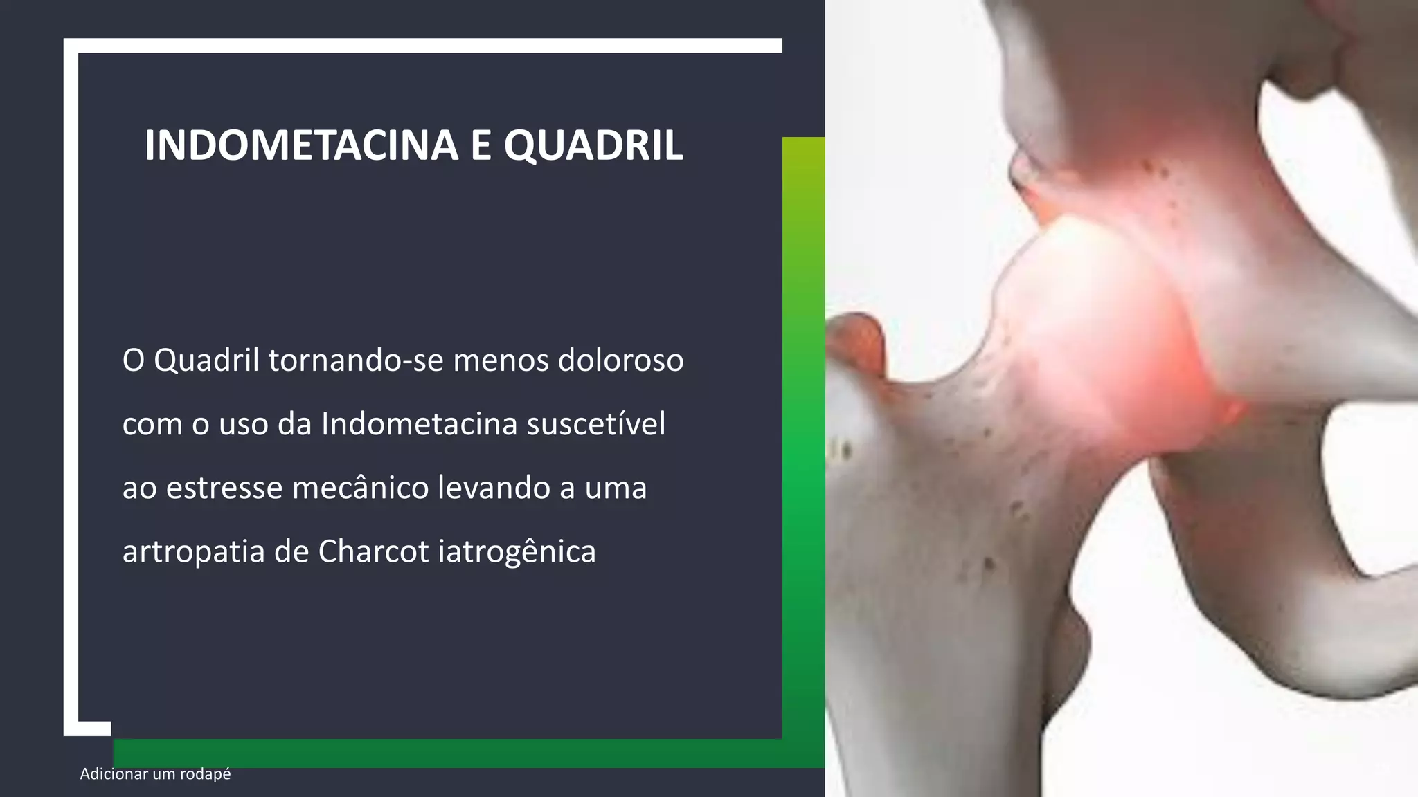 O Quadril tornando-se menos doloroso
com o uso da Indometacina suscetível
ao estresse mecânico levando a uma
artropatia de Charcot iatrogênica
INDOMETACINA E QUADRIL
Adicionar um rodapé 29
 