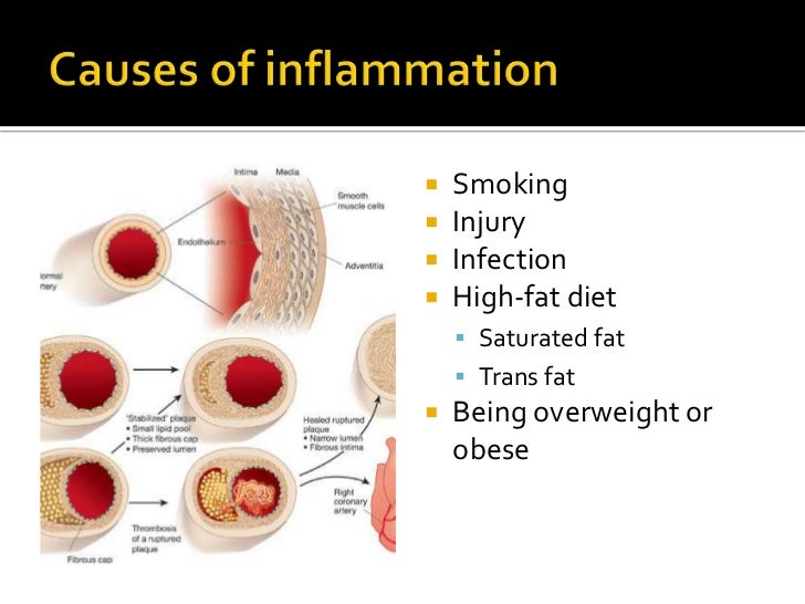 anti inflammatory anti inflammatory diet anti inflammatory anti inflammatory diet