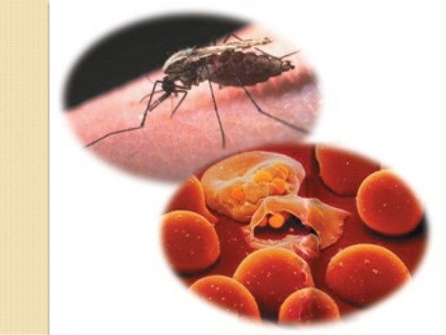 Малярией можно заразиться. Укус малярийного плазмодия.