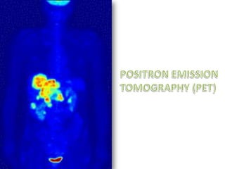 POSITRON EMISSION TOMOGRAPHY (PET)