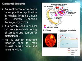  Antimatter-matter reaction
have practical application
in medical imaging , such
as Positron Emission
Tomography (PET).
 It is heavily used in clinical
oncology (medical imaging
of tumours and search for
metastases).
 PET is also an important
research tool to map
normal human brain and
heart function.
15
 