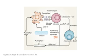Comprehensive Overview of Anti-Glomerular Basement Membrane Disease ...