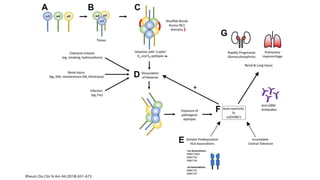 Comprehensive Overview of Anti-Glomerular Basement Membrane Disease ...