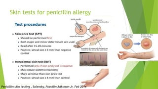Skin tests for penicillin allergy
Penicillin skin testing , Solensky, Franklin Adkinson Jr, Feb 2014
 