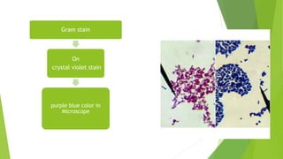 Gram stain
On
crystal violet stain
purple blue color in
Microscope
 