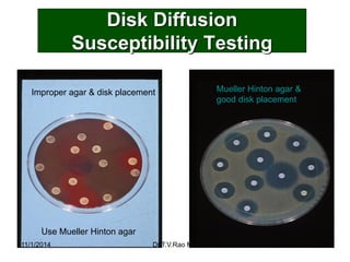 Disk Diffusion Susceptibility Testing 
Improper agar & disk placement 
Mueller Hinton agar & 
good disk placement 
Use Mue...