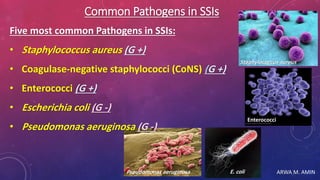 ARWA M. AMINPseudomonas aeruginosa
Common Pathogens in SSIs
Five most common Pathogens in SSIs:
• Staphylococcus aureus (G +)
• Coagulase-negative staphylococci (CoNS) (G +)
• Enterococci (G +)
• Escherichia coli (G -)
• Pseudomonas aeruginosa (G -)
Staphylococcus aureus
Enterococci
E. coli
 