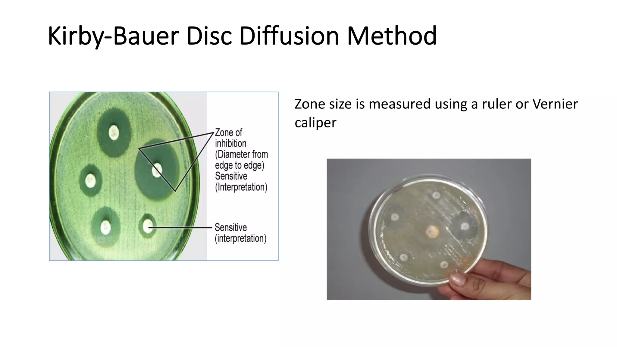 Antimicrobial susceptibility testing- Microbiology | PDF