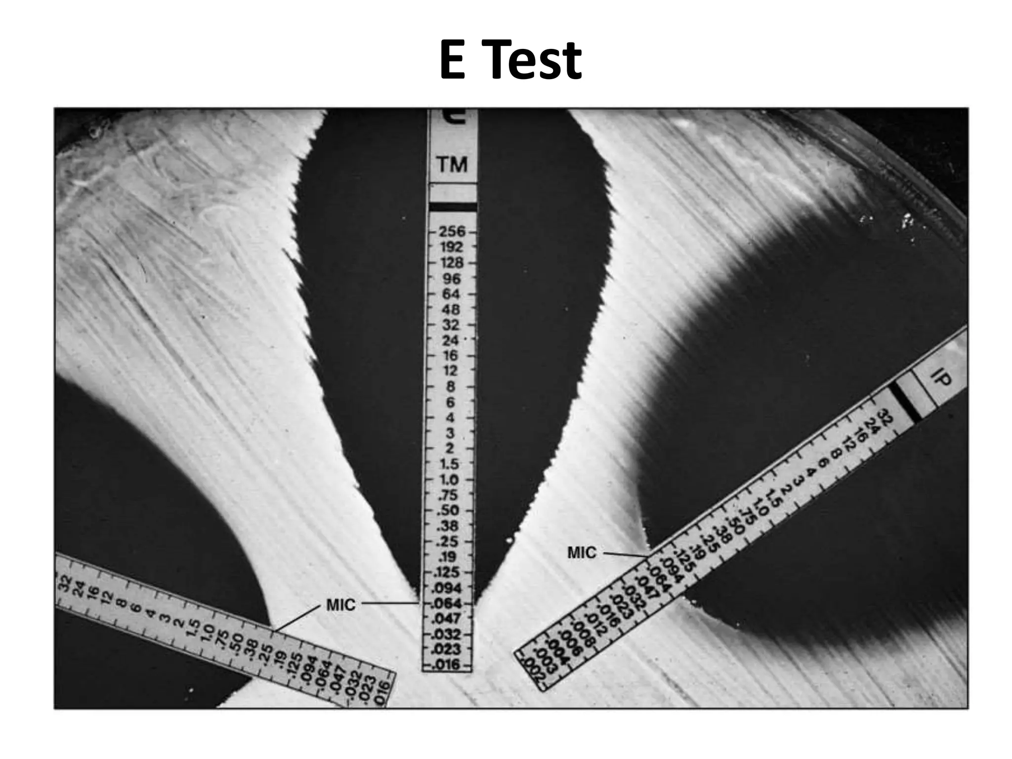 E Test
 