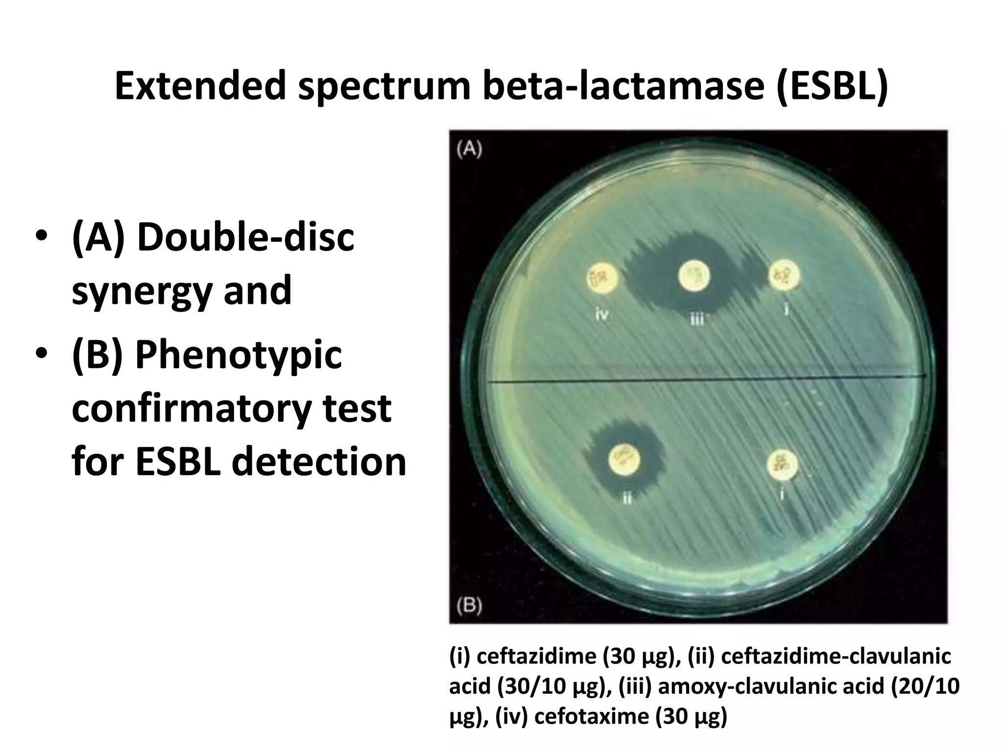 • (A) Double-disc
synergy and
• (B) Phenotypic
confirmatory test
for ESBL detection
Extended spectrum beta-lactamase (ESBL)
(i) ceftazidime (30 μg), (ii) ceftazidime-clavulanic
acid (30/10 μg), (iii) amoxy-clavulanic acid (20/10
μg), (iv) cefotaxime (30 μg)
 