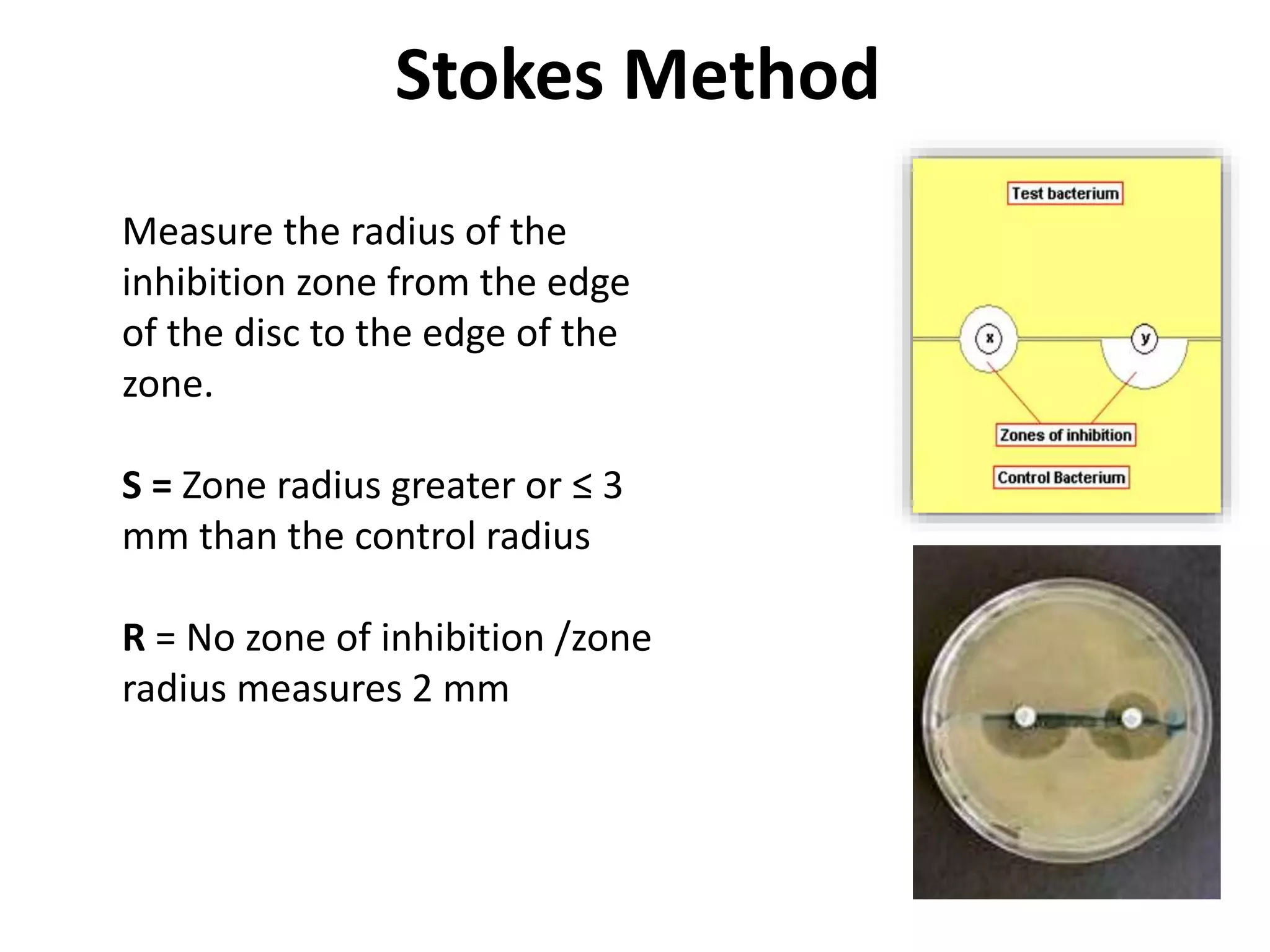 Stokes Method
Measure the radius of the
inhibition zone from the edge
of the disc to the edge of the
zone.
S = Zone radius greater or ≤ 3
mm than the control radius
R = No zone of inhibition /zone
radius measures 2 mm
 