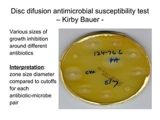 Antimicrobial susceptibility testing an overview of definitions and ...