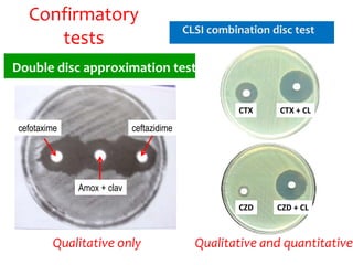 Icil
Confirmatory
tests
Double disc approximation test
Qualitative only
CLSI combination disc test
Qualitative and quantitative
CTX CTX + CL
CZD CZD + CL
cefotaxime ceftazidime
Amox + clav
 