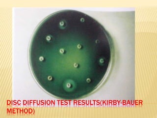 DISC DIFFUSION TEST RESULTS(KIRBY-BAUER
METHOD)
 