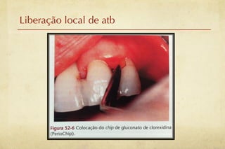 Liberação local de atb
 