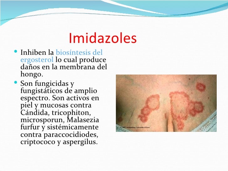 Que es posible se librará del hongo sobre las uñas de los pies