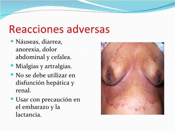 Ekzoderil el precio en krasnodare los análogos