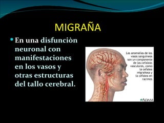 MIGRAÑA
 En una disfunciòn
 neuronal con
 manifestaciones
 en los vasos y
 otras estructuras
 del tallo cerebral.
 
