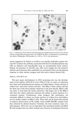 Antinuclear antobdy testing | PDF