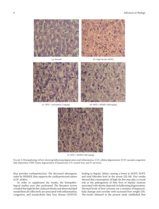6 Advances in Biology
(a) Normal
FDH
VCD
(b) High-fat diet (HFD)
CD
CV
(c) HFD + simvastatin (3 mg/kg)
CD
FDH
(d) HFD + MEMO (200 mg/kg)
FDH
CD
(e) HFD + MEMO (400 mg/kg)
Figure 3: Histopathology of liver showing ballooning degeneration and inflammation. (CD: cellular degeneration, VCD: vascular congestion
fatty deposition, FDH: foamy degeneration of hepatocytes, CV: central vein, and N: necrosis).
thus provides cardioprotection. The decreased atherogenic
index by MEMOL thus supports the cardioprotectant nature
of M. oleifera.
In order to supplement the results, the histopatho-
logical studies were also performed. The literature review
revealed that high fat diet-induced obesity and abnormal lipid
metabolism all collectively are associated with inflammation,
congestion, and nonalcoholic fatty liver disease (NAFLD)
leading to hepatic failure causing a boost in SGOT, SGPT,
and total bilirubin level in the serum [52–54]. Our results
showed that consumption of high-fat diet may play a crucial
role in the pathogenesis of fatty liver or hepatic steatosis
associated with obesity depicted via ballooning degeneration.
Elevated levels of liver enzymes are a monitor of hepatocel-
lular damage and correlate with increased liver weight [55].
The results obtained in the present study established that
 