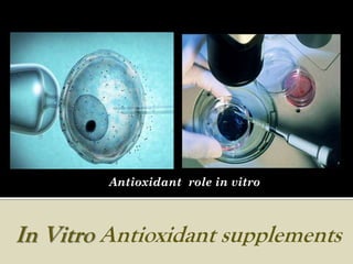 Antioxidant role in vitro



In Vitro Antioxidant supplements
 