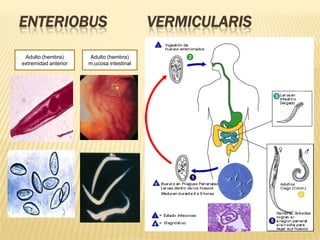 ENTERIOBUS                                 VERMICULARIS

 Adulto (hembra)       Adulto (hembra)
extremidad anterior   m,ucosa intestinal
 