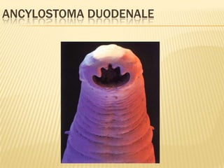 ANCYLOSTOMA DUODENALE
 