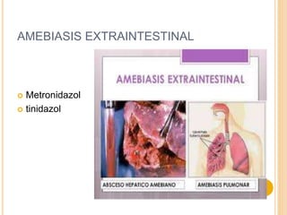 AMEBIASIS EXTRAINTESTINAL
 Metronidazol
 tinidazol
 