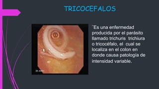 TRICOCEFALOS
¨Es una enfermedad
producida por el parásito
llamado trichuris trichiura
o tricocéfalo, el cual se
localiza en el colon en
donde causa patología de
intensidad variable.
 
