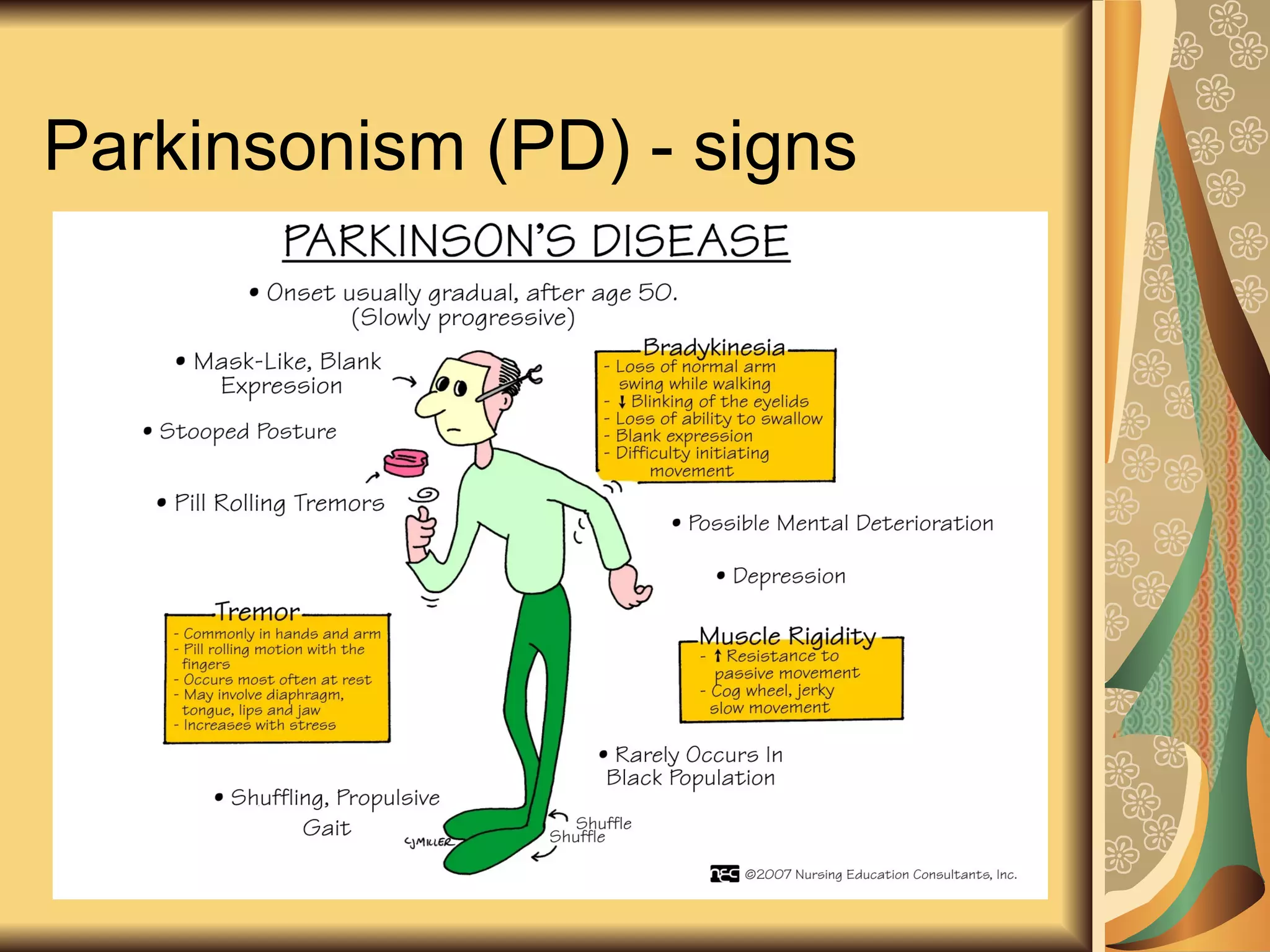 Parkinsonism (PD) - signs
 