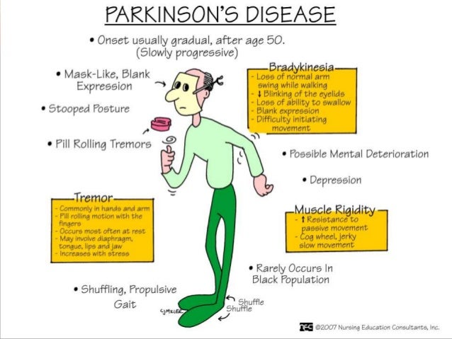 Levodopa Drug Toxicity