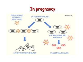 IInn pprreeggnnaannccyy 
 