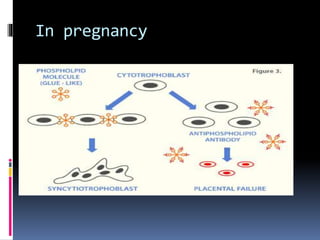 In pregnancy 
 