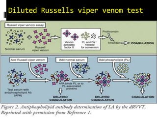 Diluted Russells viper venom test 
 