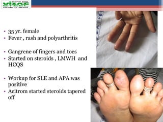 Anti phospholipid syndrome (aps ) | PPT