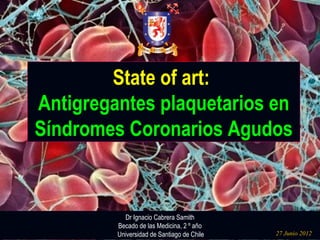 State of art:
Antigregantes plaquetarios en
Síndromes Coronarios Agudos


           Dr Ignacio Cabrera Samith
         Becado de las Medicina, 2 º año
         Universidad de Santiago de Chile   27 Junio 2012
 