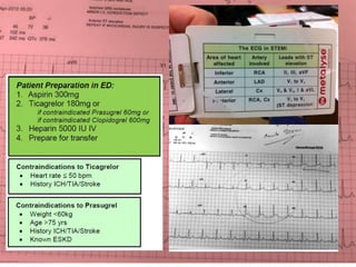 Antiplatelets and anticoagulation in AMI