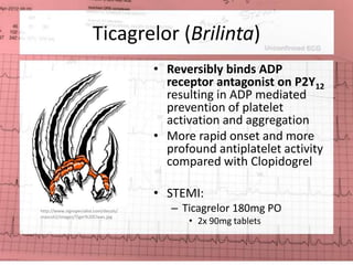 Ticagrelor (Brilinta) 
• Reversibly binds ADP 
receptor antagonist on P2Y12 
resulting in ADP mediated 
prevention of platelet 
activation and aggregation 
• More rapid onset and more 
profound antiplatelet activity 
compared with Clopidogrel 
• STEMI: 
– Ticagrelor 180mg PO 
• 2x 90mg tablets 
http://www.signspecialist.com/decals/ 
mascot2/images/Tiger%20Claws.jpg 
 
