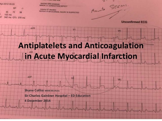 Why Is Clopidogrel Considered An Anticoagulant