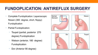 Antireflux surgery Dr Sumantra Ray Manipal.pptx