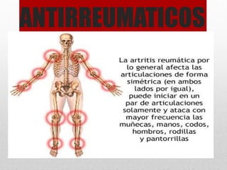 ANTIRREUMATICOS
 