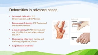 Deformities in advance cases
• Swan neck deformity: PIP
Hyperextension and DIP flexion
• Boutonniere deformity: PIP flexion and
DIP Hyperextension
• Z like deformity: DIP Hyperextension
and fixed flexion and subluxation of
the MCP
• Hammer toe (claw toe): Curling and
stiffening of position of toes
• Carpel tunnel syndrome
 